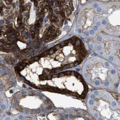 Immunohistochemistry-Paraffin: HIP1 Antibody [NBP1-81593]