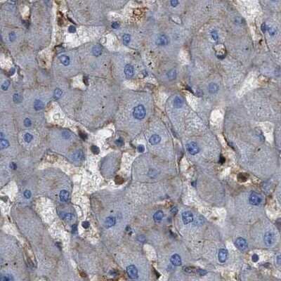 Immunohistochemistry-Paraffin: HIP1 Antibody [NBP1-81593]