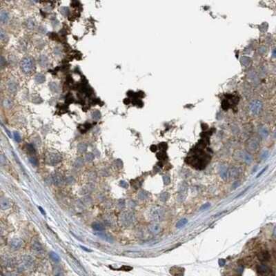 Immunohistochemistry-Paraffin: HIP1 Antibody [NBP1-81593]