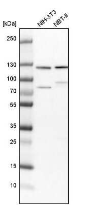 Western Blot: HIP1 Antibody [NBP1-81592]