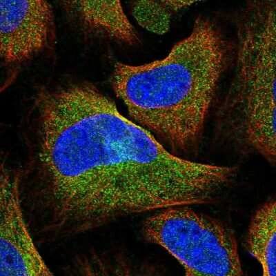 Immunocytochemistry/ Immunofluorescence: HIP1 Related Antibody [NBP2-38391]