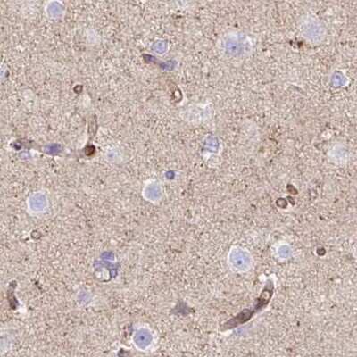 Immunohistochemistry-Paraffin: HIP1 Related Antibody [NBP2-38391]