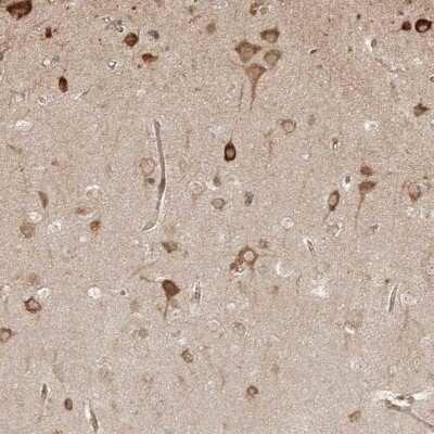 Immunohistochemistry-Paraffin: UBE2K/E2-25K Antibody [NBP1-91987]