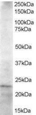 Western Blot: UBE2K/E2-25K Antibody [NB300-840]