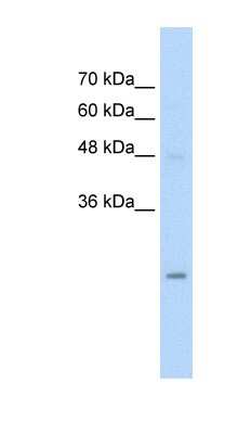 Western Blot: UBE2K/E2-25K Antibody [NBP1-54914]