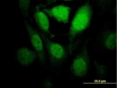 Immunocytochemistry/ Immunofluorescence: HIPK1 Antibody (1F2) [H00204851-M04]