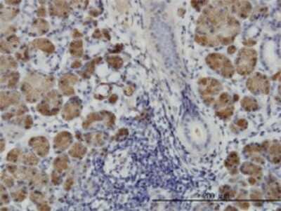 Immunohistochemistry-Paraffin: HIPK1 Antibody (4C2) [H00204851-M01]