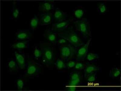 Immunocytochemistry/ Immunofluorescence: HIPK1 Antibody (4E1) [H00204851-M07]