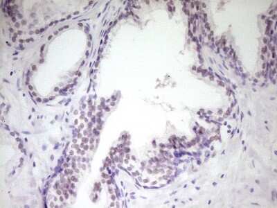 Immunohistochemistry: HIPK1 Antibody (OTI5F1) [NBP2-45973]