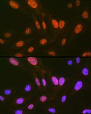 Immunocytochemistry/ Immunofluorescence: HIPK2 Antibody (3Z5P6) [NBP3-16825]