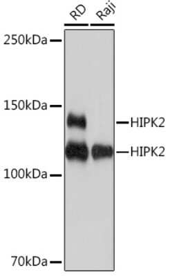 Western Blot: HIPK2 Antibody (3Z5P6) [NBP3-16825]
