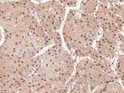 Immunohistochemistry-Paraffin: HIPK2 Antibody [NBP2-99584]