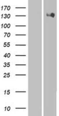 Western Blot: HIPK2 Overexpression Lysate [NBP2-06409]