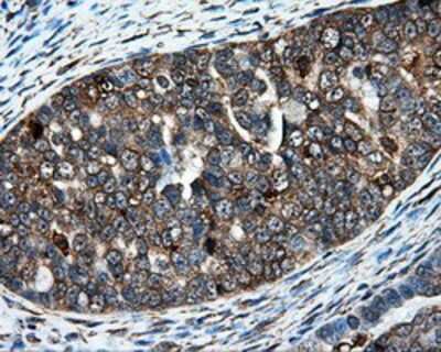Immunohistochemistry-Paraffin: HIPPI Antibody (OTI4F6) [NBP2-02313]