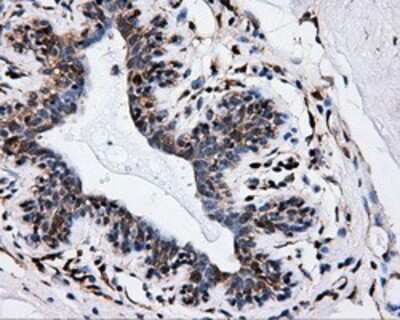 Immunohistochemistry-Paraffin: HIPPI Antibody (OTI4F6) [NBP2-02313]