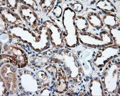 Immunohistochemistry-Paraffin: HIPPI Antibody (OTI4F6) [NBP2-02313]
