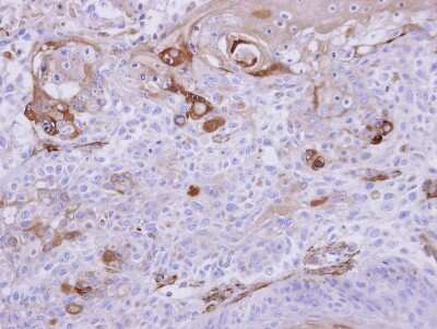 Immunohistochemistry-Paraffin: HIPPI Antibody [NBP1-32932]
