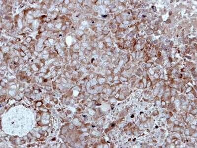 Immunohistochemistry-Paraffin: HIPPI Antibody [NBP2-16835]