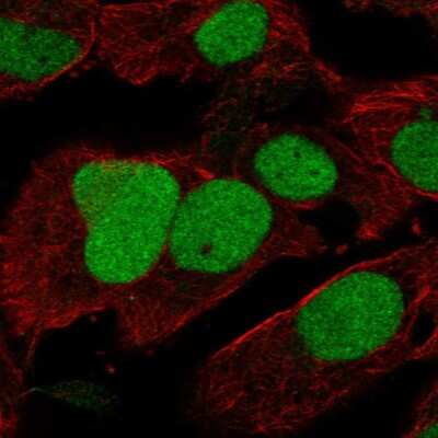Immunocytochemistry/ Immunofluorescence: HIRIP3 Antibody [NBP2-38020]