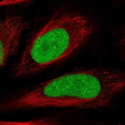 Immunocytochemistry/ Immunofluorescence: HIRIP3 Antibody [NBP2-55101]