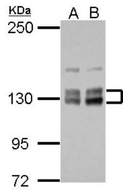 Western Blot: HISPPD1 Antibody [NBP2-16836]