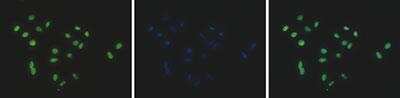 Immunocytochemistry/ Immunofluorescence: HIST1H2AD Antibody [NBP3-11870]