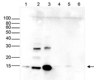 Western Blot: HIST1H2AD Antibody [NBP3-11870]