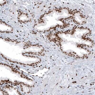 Immunohistochemistry: HIST1H2AG Antibody (CL5041) [NBP2-61152]