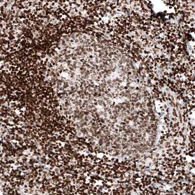 Immunohistochemistry: HIST1H2AG Antibody (CL5041) [NBP2-61152]