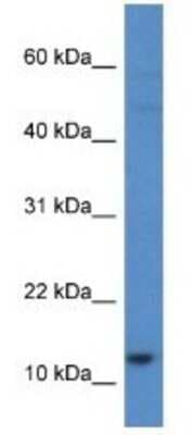 Western Blot: HIST1H2AH Antibody [NBP1-79874]