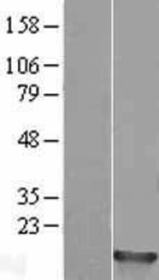 Western Blot: HIST1H2BM Overexpression Lysate [NBP2-07987]