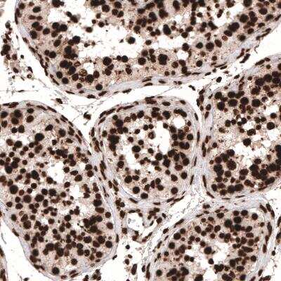 Immunohistochemistry-Paraffin: HIST1H3A Antibody (CL4967) [NBP2-61150]