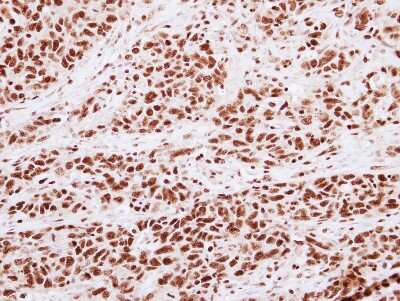 Immunohistochemistry-Paraffin: HIST1H3A Antibody [NBP2-16838]