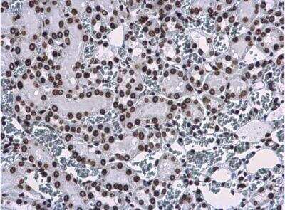Immunohistochemistry-Paraffin: HIST1H3A Antibody [NBP2-16841]