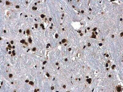 Immunohistochemistry-Paraffin: HIST1H3A Antibody [NBP2-16842]