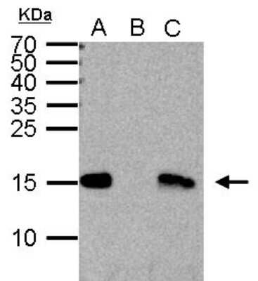 Immunoprecipitation: HIST1H3A Antibody [NBP2-16838]