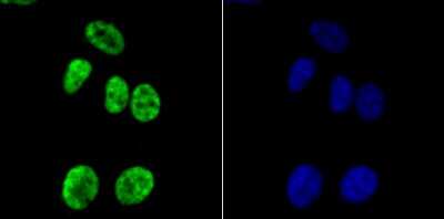 Immunocytochemistry/ Immunofluorescence: HIST1H3A Antibody (JU43-26) [NBP2-75522]