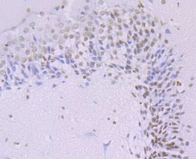 Immunohistochemistry-Paraffin: HIST1H3A Antibody (JU43-26) [NBP2-75522]