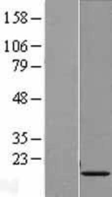 Western Blot: HIST1H3G Overexpression Lysate [NBP2-07994]