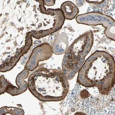 Immunohistochemistry-Paraffin: HIV-1 Rev binding protein Antibody [NBP1-91991]