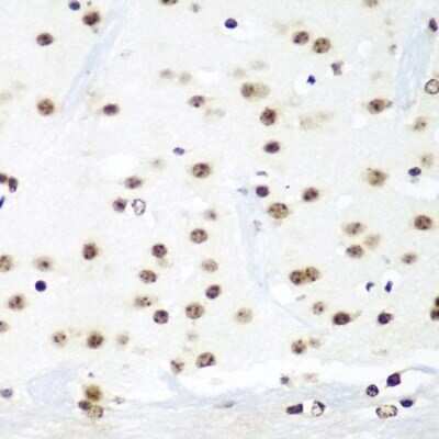 Immunohistochemistry-Paraffin: HIV-1 Tat specific factor 1 Antibody - BSA Free [NBP3-03409]