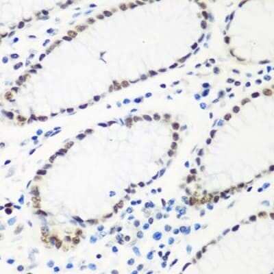 Immunohistochemistry-Paraffin: HIV-1 Tat specific factor 1 Antibody - BSA Free [NBP3-03409]