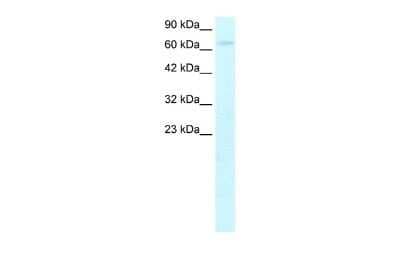 Western Blot: HIV-1 Tat specific factor 1 Antibody [NBP2-87571]