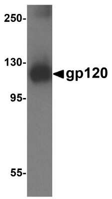 Western Blot: HIV-1 gp120 AntibodyBSA Free [NBP2-81822]