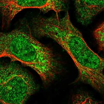 Immunocytochemistry/ Immunofluorescence: HIVEP1 Antibody [NBP2-30785]