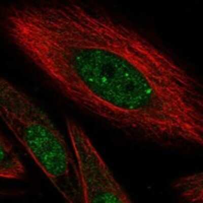Immunocytochemistry/ Immunofluorescence: HIVEP1 Antibody [NBP3-17504]