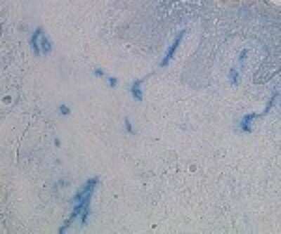 Immunohistochemistry: HKCR Antibody (117E10.10) [DDX0351P-100]