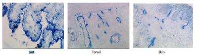 Immunohistochemistry: HKCR Antibody (117E10.10) [DDX0351P-100]