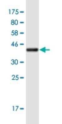 Western Blot: HKR1 Antibody (8E5) [H00284459-M06-100ug]