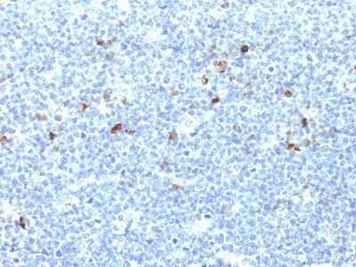 Immunohistochemistry-Paraffin: HLA A Antibody (CATA-1) - Azide and BSA Free [NBP2-47673]